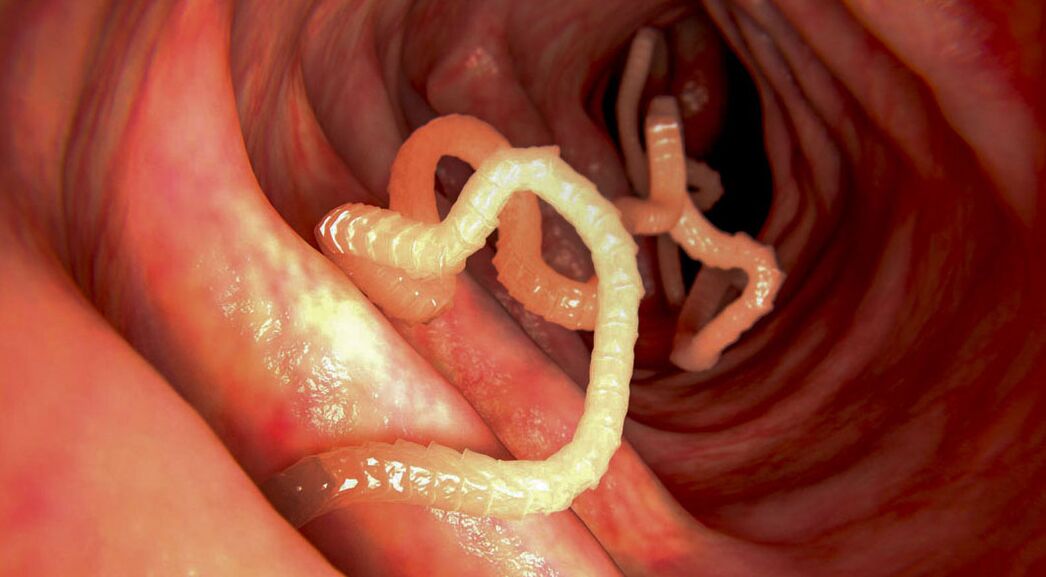 Diagnosis of parasites in the intestines