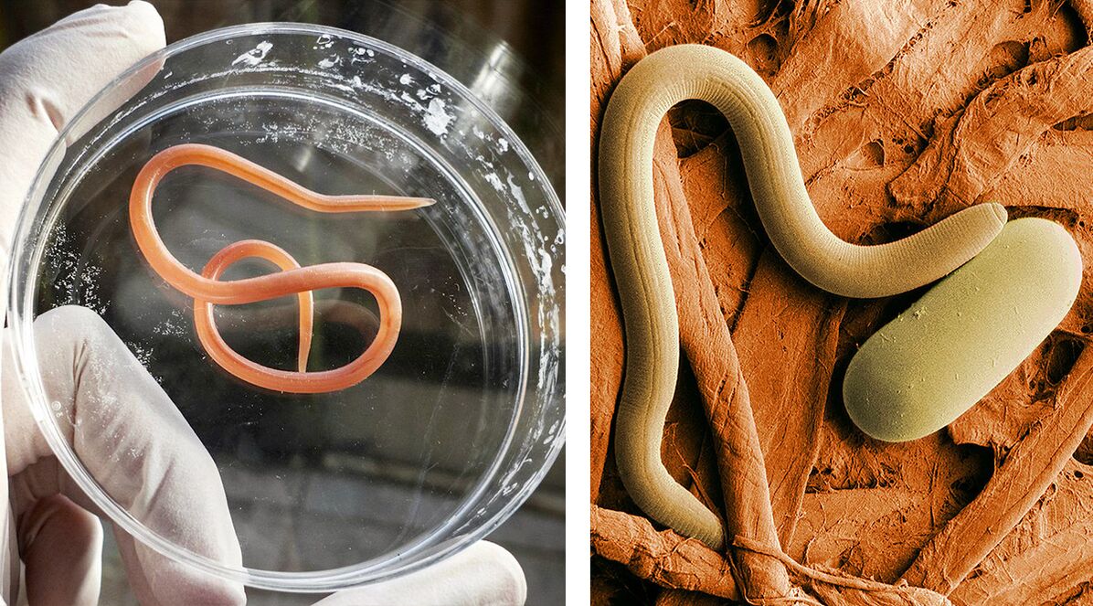 Parasites in the human body