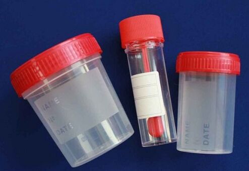 Jars for testing for parasites