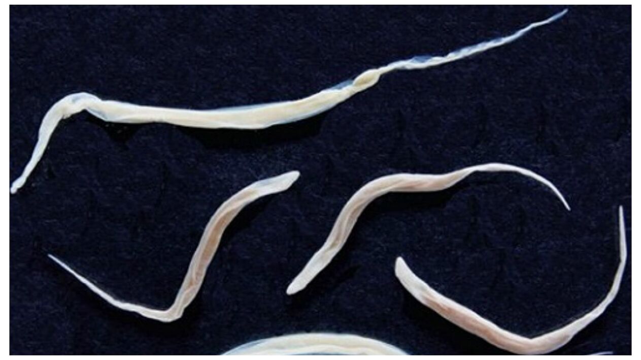 Pinworms are common parasites that belong to the helminth group.